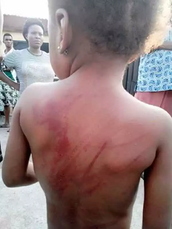 Omg! For Misplacing Her Slippers, See What Father Did To Her 4-Years-Old Girl (Photos)